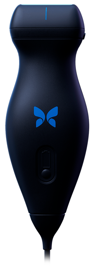 Aparelho de Ultrassom Portátil Butterfly